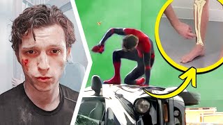 Film Çekimlerinde Yaralanan Örümcek Adam Oyuncuları Tom Holland Tobey Maguire Vs 