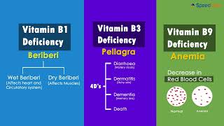 Class-6-Science-Ch-11-Components of Food-Topic- Water soluble Vitamins and their deficiencies