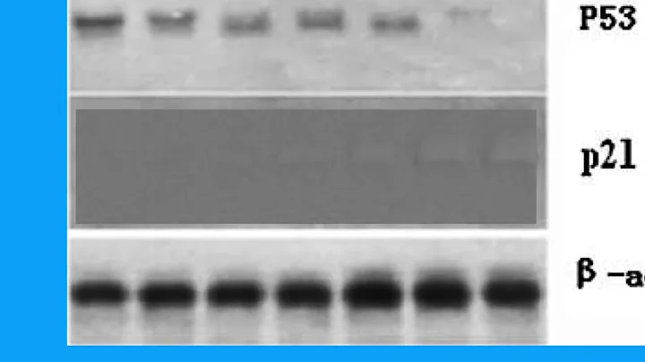 437E291762AA2ED2FF699BB03C350F#1