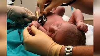 Most common causes of wheezing in pediatrics