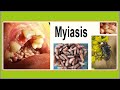 myiasis