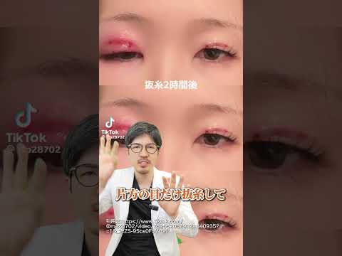 【抜糸】痛々しい...