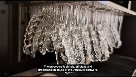 Dr. Anna Babczyńska-Staszewska on 3D printed Bleaching Trays