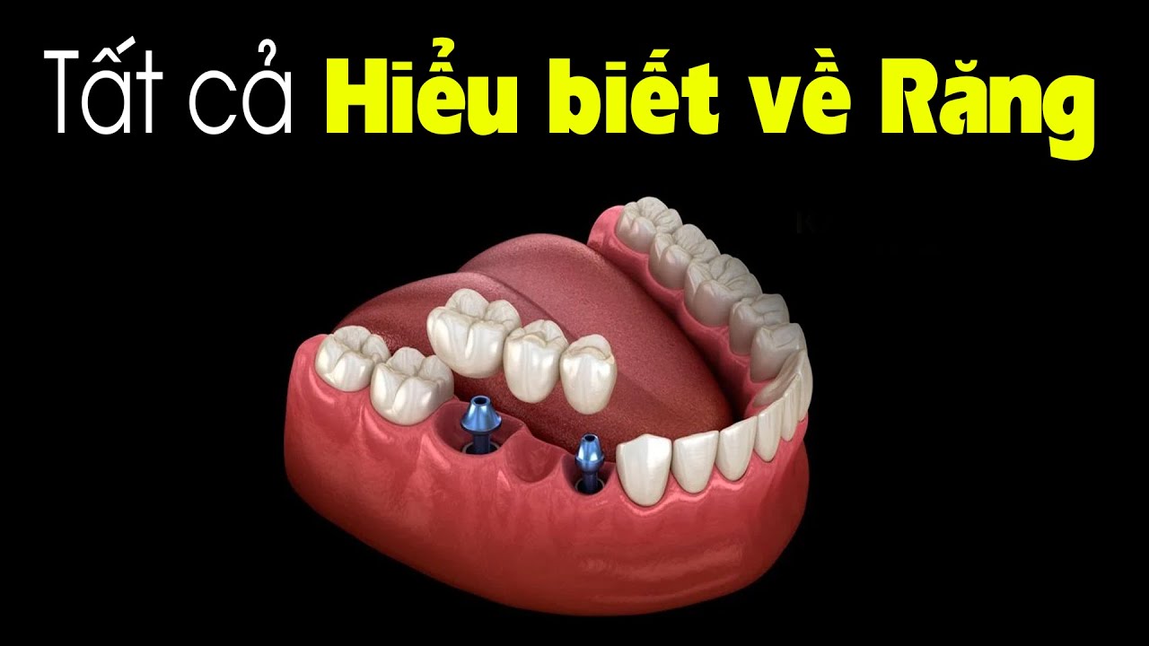 Outline Video Tổng hợp tất cả kiến thức về Răng bạn nên xem
