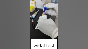 Widal test ( typhoid test) #bmlt #dmlt #labtechnician