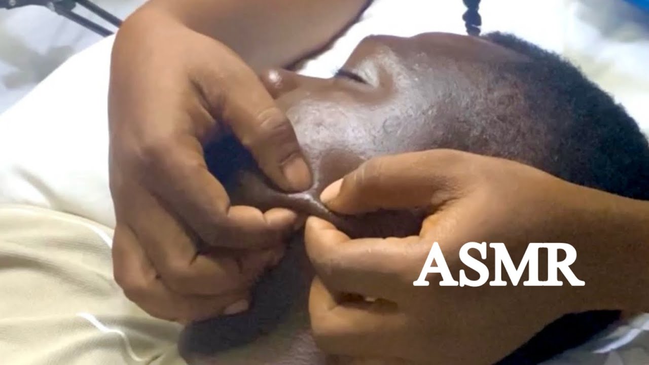 ASMR✨SATISFYING FULL FACE NITPICKING PIMPLE POPPING, INGROWN REMOVAL AND WHISPERING YOU A STORY