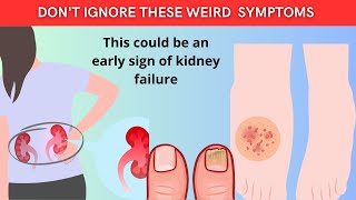 11 Signs Your Kidneys Are Failing - Don't Miss These Red Flags!