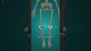 Why Bow-Legged Knees Wear Out Cartilage Faster | Animation Explained #cartilagehealth Why Bow-Legged Knees Wear Out Cartilage Faster | Animation Explained #cartilagehealth