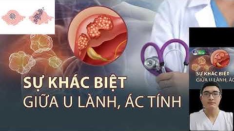 U lành tính khác U ác tính (Ung thư) như thế nào?| Kiến thức cùng Thiện