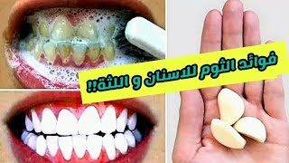 علاج تسوس الأسنان التهاب اللثة و رائحة الفم الكريهة في المنزل 
