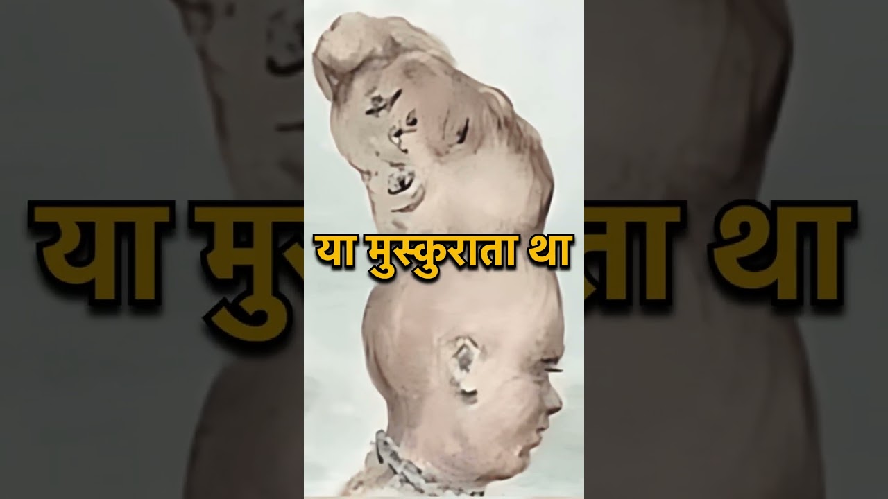 The Amazing Two-Headed Boy of India!!