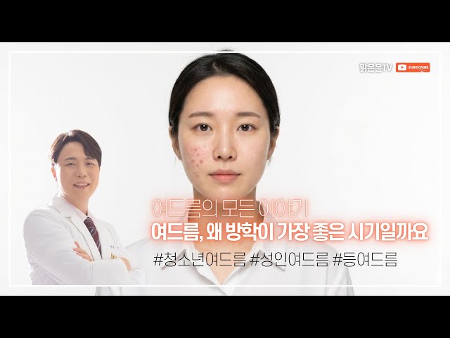 여드름 치료, 왜 방학이 가장 좋은 시기일까요 by #맑은윤의원 용인점 구의점 #용인피부과 #언남동피부과 #구의동피부과 #광진구피부과