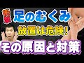 【足のむくみ(浮腫)】放置は危険!その原因と症状、治療、予防法について現役医師が解説します。