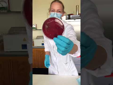 Video: Was sind aseptische Techniken im mikrobiologischen Labor?