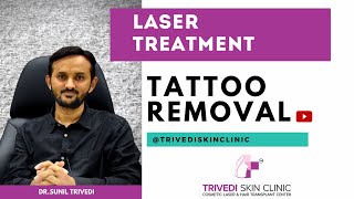 Permanent Tattoo Removal | हमेशा के लिए परमानेंट टैटू कैसे हटवाएं | Trivedi Skin Clinic | Surat-Guj.