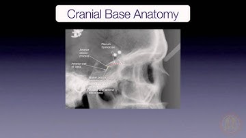 Cranial Base Superimposition