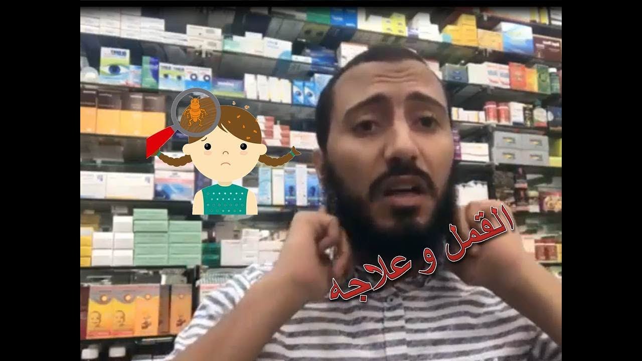 القمل واسبابه وعلاجه وكل ماتريد معرفته عنه