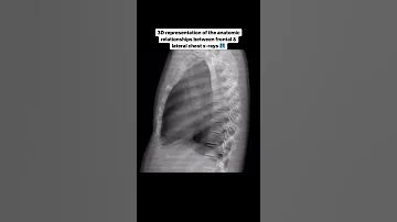 Frontal Lateral Chest X RAY 3D Representation 