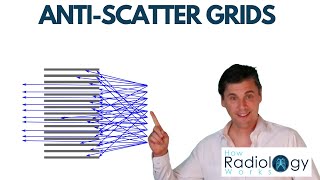 Download Lagu X-ray Scatter and Anti-Scatter Grids MP3