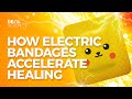 How Electric Bandages Accelerate Healing