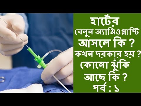 ভিডিও: বেলুন কি