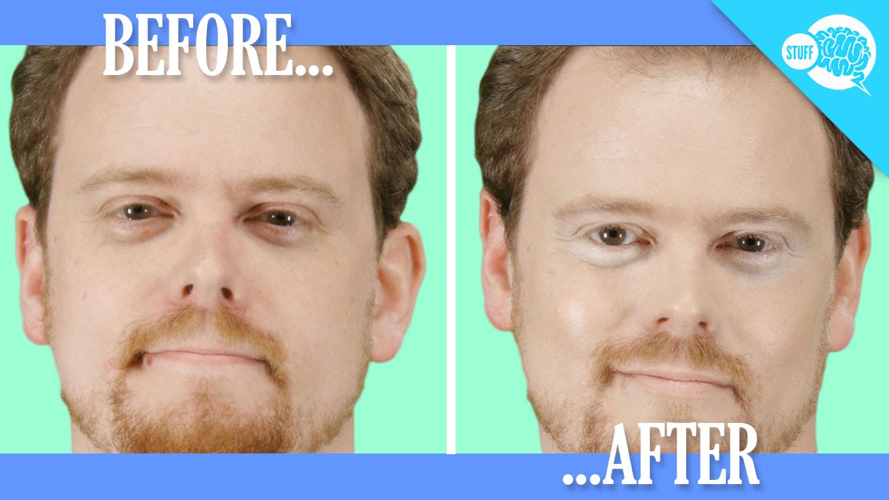 How to improve the appearance of bags under your eyes