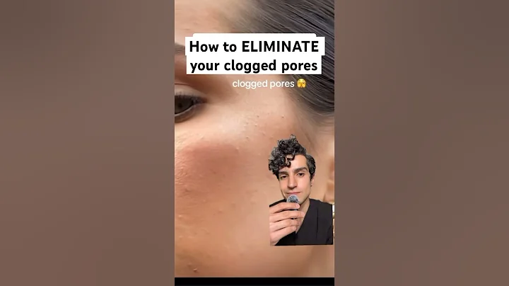 Derm reveals how to treat your clogged pores #cloggedpores #pores #dermatologist #whiteheads