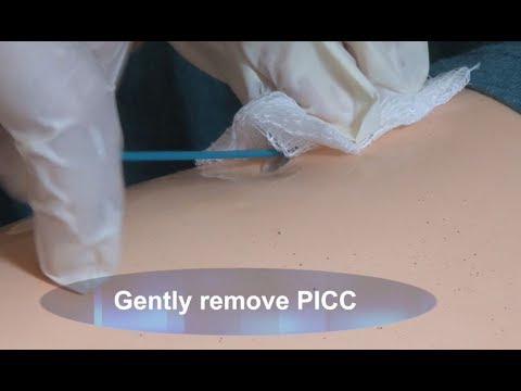 How to Remove a PICC Demo