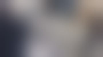 Robotic Endoluminal Bronchoscopy Utilizing Cone Beam CT