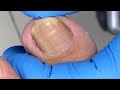 Pedicure tutorial ：What a sharp nail【Xue Yidao】