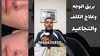 كريم أكثر من رائع في إزالة الكلف والتجاعيد مجرب