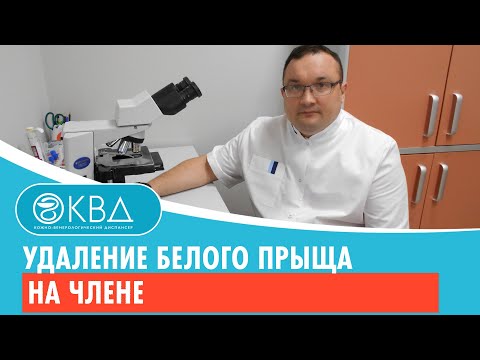 ✅ Удаление белого прыща на члене. Клинический случай №479