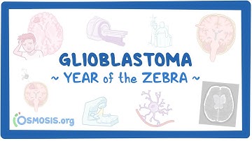 Glioblastoma (Year of the Zebra)