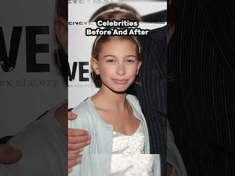Celebrities Before And