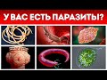 Опасные ПАРАЗИТЫ в человеке: НЕ ДАЙ СЕБЯ УБИТЬ! / Самое популярное средство от глистов