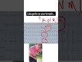 This ECG has a distinct smell. Did you sniff it out?