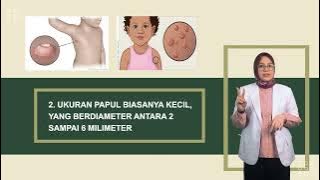 Video Edukasi Moluskum Kontagiosum