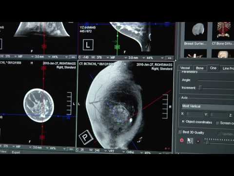 Breast Imaging Technology - Breast CT Scanning