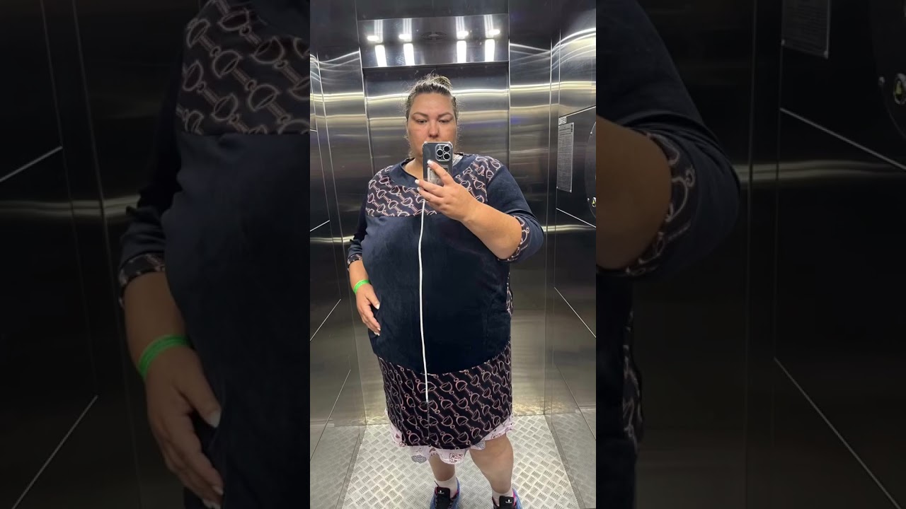 Шесть месяцев после бариатрической операции.  Минус 61,7 кг на весах 