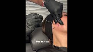 Thread lifting! What is a PDO thread to help collagen  #pdothread #pdothreadlift #education #skin