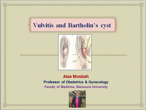 Vulvitis and Bartholin’s cyst