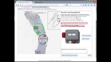 Ki67 Reproducibility Study Phase 3 Demo Video #4 (of 5)