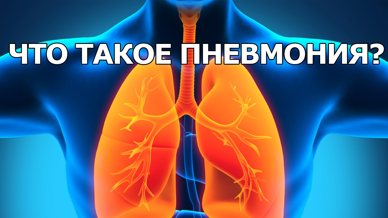 Что такое пневмония? - YouTube