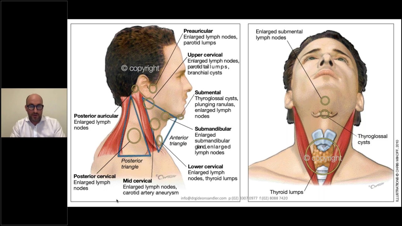 Neck Lumps In General Practice Youtube