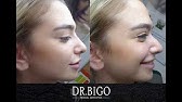 איך להקטין ולקצר את האף בפחות מ 3 דקות Nose Contouring Youtube