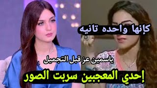 صدق أو لا تصدق ياسمين عز قبل عمليه التجميل بعد نصيحتها للبنات بعدم إجراء تجميل