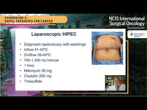 NCIS ISOS 2021 - Laparoscopic HIPEC