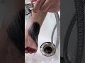 Dad Itchy Hand Mystery