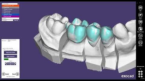 exocad Quick Guide  The 