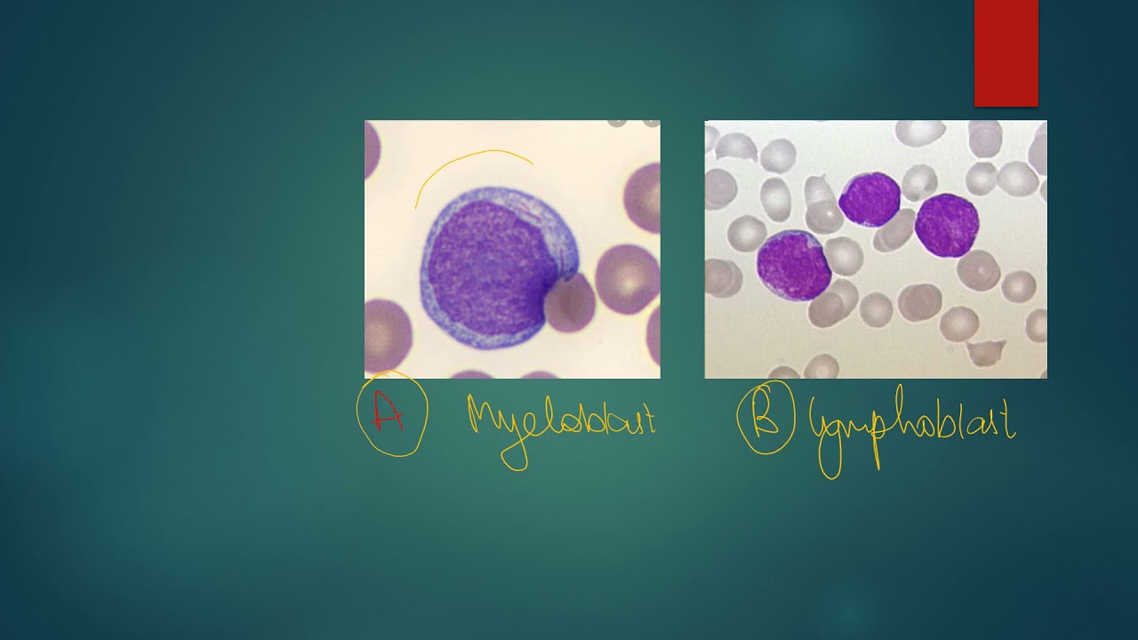 myeloblast